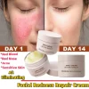 High Quality Facial Redness Repair Cream Repair Skin Rosacea Red Blood Cellulite Shrink Pores Free Shipping Korean Cosmetics